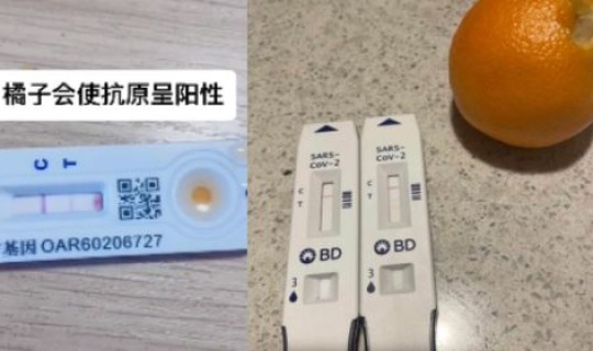 笔记本检测阳性，实验室检查阳性是什么意思