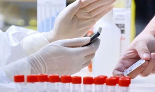 核酸检测取消了(核酸检测为什么不能排除hiv)