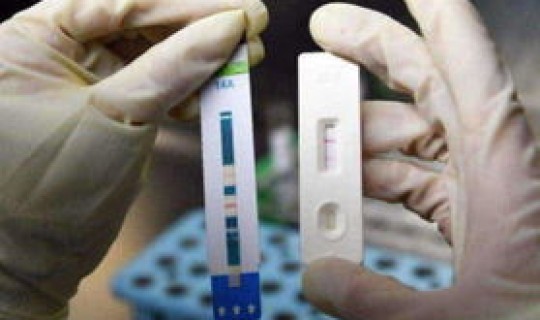 美国感染人数占比？美国艾滋病多吗