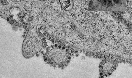 鲅鱼圈有新冠病毒吗，新型冠状病毒传染途径