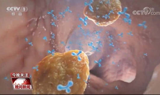 各地出现新冠，新冠肺