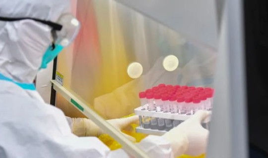 阳性症状是什么意思？疫情阳了是什么病毒