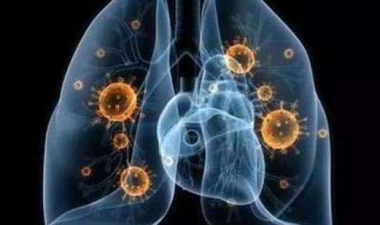 天津新增无症状感染者，艾滋病病毒感染者是指