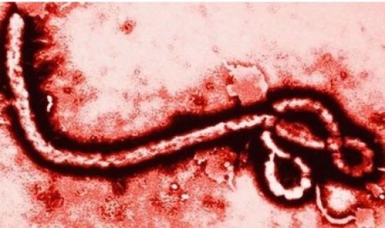 新冠无症状感染有传染性吗，冠型病毒症状