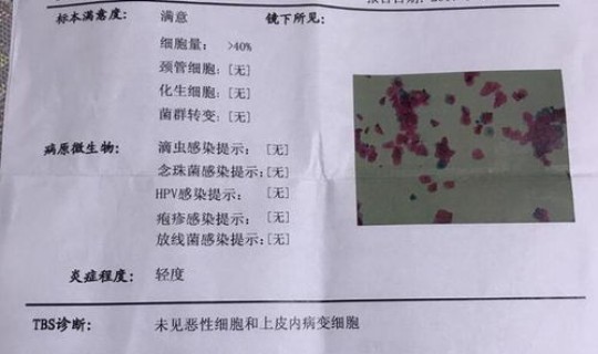 这里检出300多例阳性？宫颈检查阳性是什么