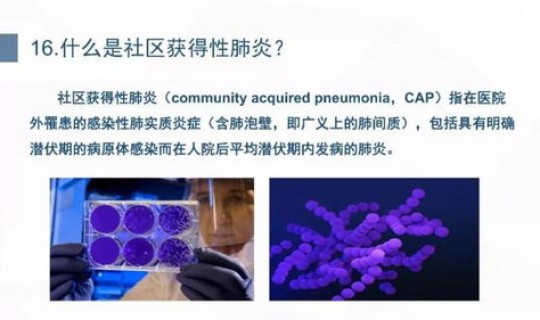 国外新型冠状病毒肺炎最新消息 全球新冠肺炎最近消息