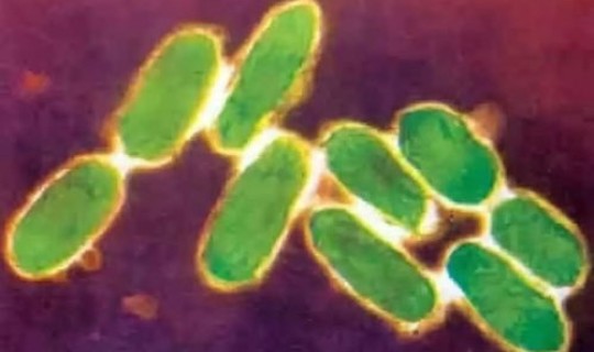 鼠疫病死率极高最严重的类型，最凶险的鼠疫类型