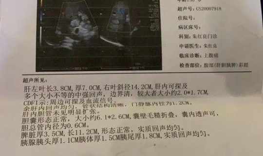 中国新冠重症患者数量？中国癌症病人数量