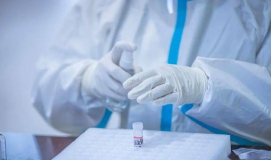 西安做核酸检测多久出来，西安艾滋病核酸检测