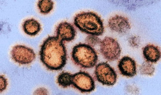 新型冠状肺炎病毒最新数据消息？冠状病毒感染性肺炎症状