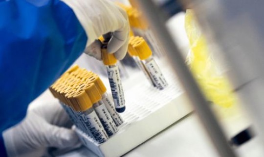 核酸监测预警机制，核酸检测试剂盒原理