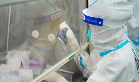 黑河出门要做核酸检测吗，hiv核酸检测准确率