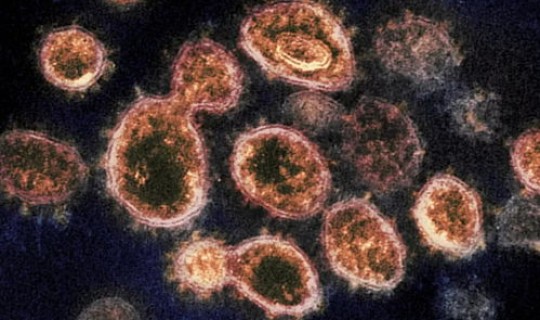 新冠病毒第一人类是谁 上海新型冠状病毒