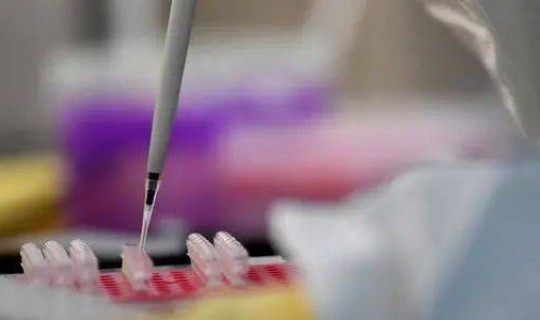 核酸检测最新发布 艾滋病核酸检测