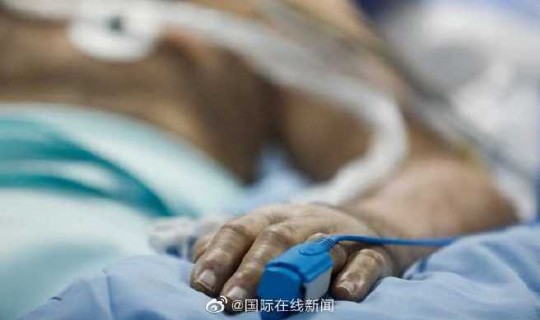 美国肺炎死亡50万 重症肺炎死亡率高吗