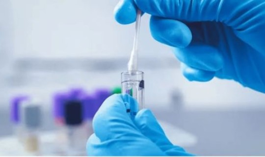 核酸检测为什么几个人一起(青岛核酸检测)