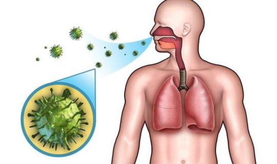 至今没有新冠肺炎的国家？肺炎是怎么引起的