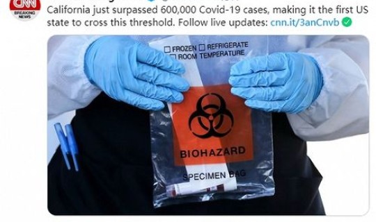 美国的新冠病毒死亡人数有多少 新冠感染了多少人