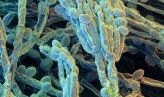 病毒多久了 艾滋病毒在空气中能存在多久