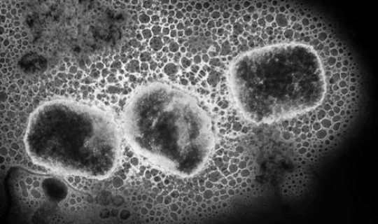 猴痘病毒的临床症状与天花相似(猴痘病毒的临床症状)