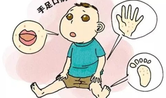 河南近期传染病症状有哪些，河南省传染病最新消息