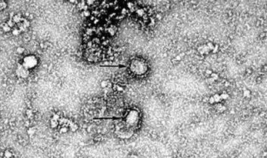 没有新型冠状病毒的国家有几个(世界唯一没有新冠病毒的国家)