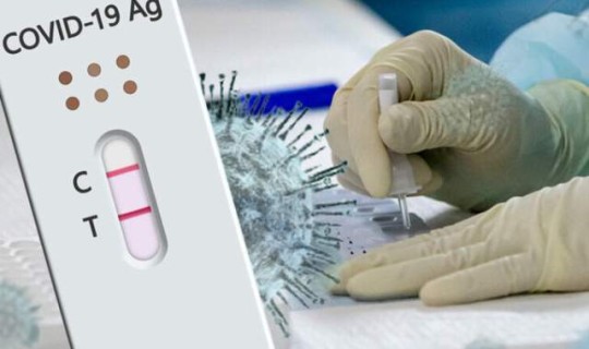 密接者隔离时间 肺结核密接者要隔离吗