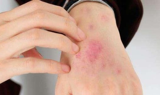 无症状感染者是否有传染性，艾滋病感染多久有症状