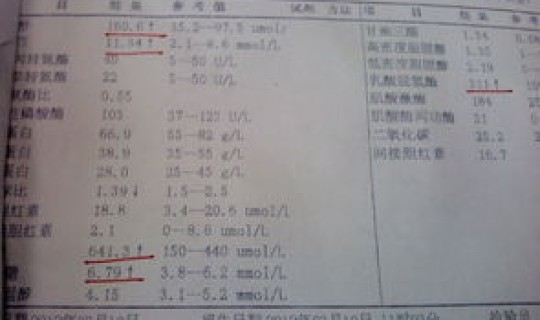疑似病例的定义临床表现 临床表现