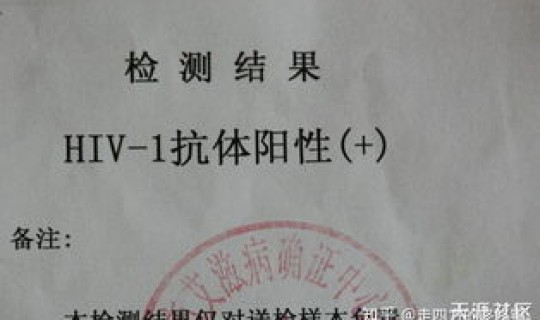 河南疾控中心通告(河南疾控中心 艾滋)