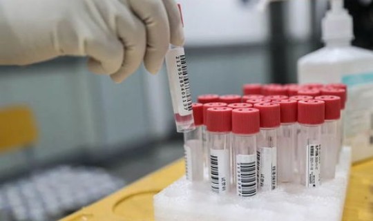 武汉全员核酸检测在哪里做的，核酸检测怎么做