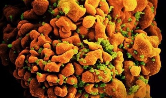 无症状感染者还用治疗吗，艾滋病病毒感染者是指