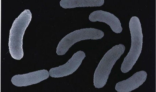 霍乱病毒现在还有吗 霍乱有多可怕