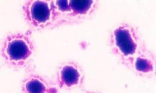 隐性感染者会不会传染，支原体感染会传染不