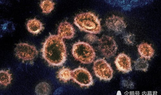 那几个国家没有新型冠状病毒肺炎，哪一个国家没有新冠病毒