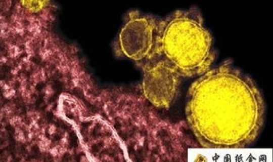 广东的病毒情况有哪些种类 病毒有哪些