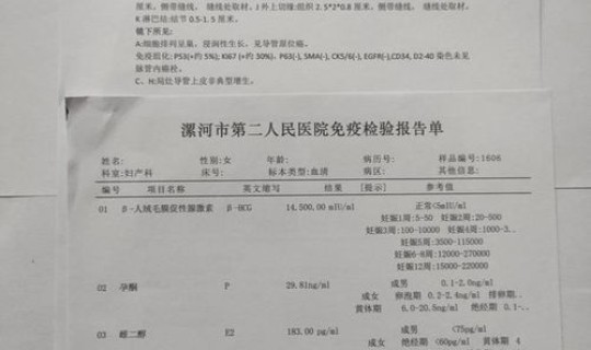 河南的病例分布？河南有病历吗