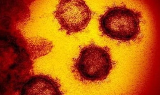 目前还没有新冠肺炎的国家？新冠病毒是哪个国家引起的