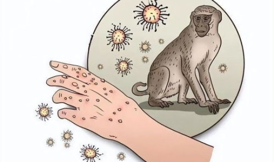 猴痘症状有哪些表现(猴痘最先出现的部位)