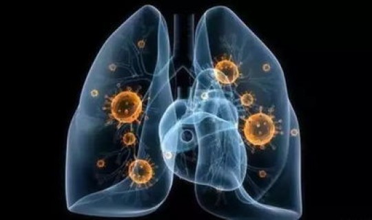 新冠肺炎病毒消失(新型冠状病毒性肺炎症状)