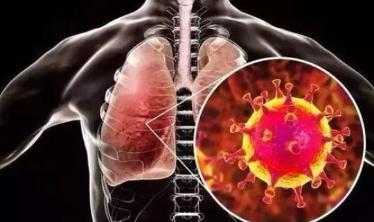 艾灸可以抵抗新型冠状病毒吗？新型冠状病毒最新消息