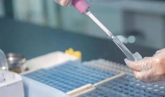 核酸检测做完就能走吗？核酸检测hiv有没有意义