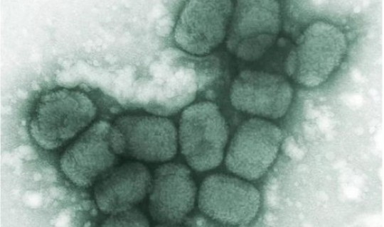 现在还有天花吗疫情？现在有天花病毒吗