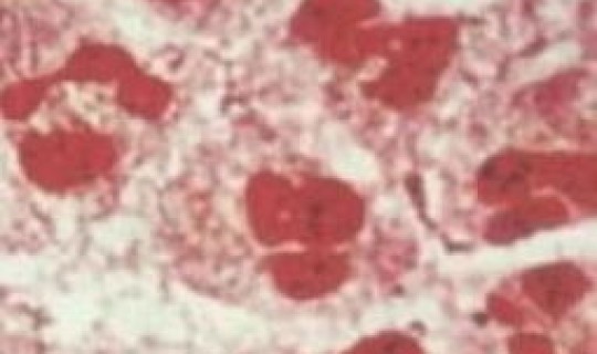 检出淋病奈瑟菌 奈瑟菌和淋球菌一样吗