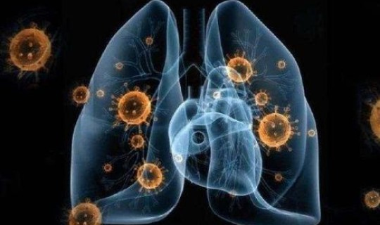 无症状感染者的传播力强吗？艾滋病病毒感染者是指