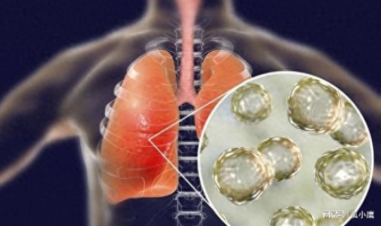 新型冠状病毒哪几个地方比较严重，冠状病毒严重吗