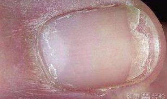 病情越来越严重了吗？为什么病越治越严重