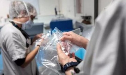 武汉的无症状感染者 艾滋病病毒感染者是指