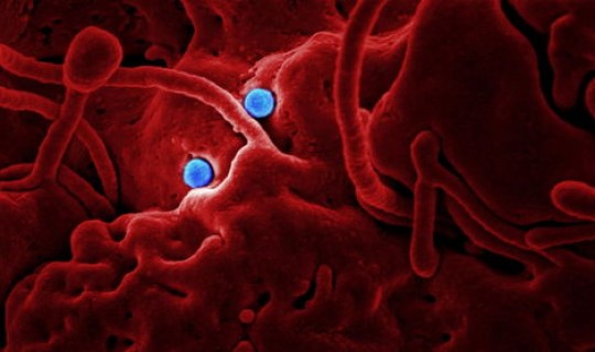 新肺炎冠状病毒人数 新型冠状病毒肺炎感染