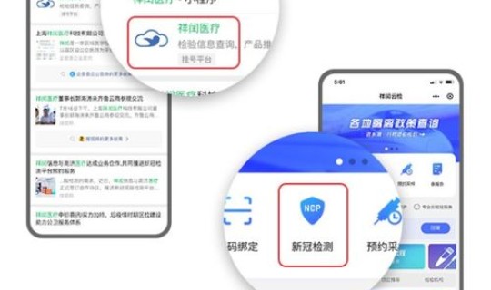现在上海需要核酸检测吗(核酸检测要多久)